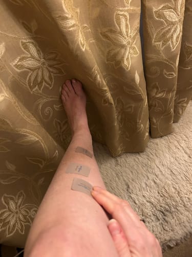 Reviewer showing three Body Relief Patches applied in a line down their lower leg for pain.