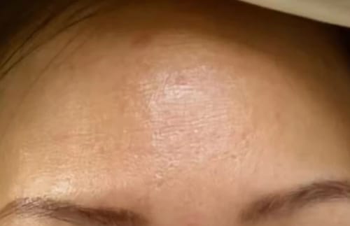 Customer photo review of OGANACELL DERX Cleanser 120mL - sensitive skin