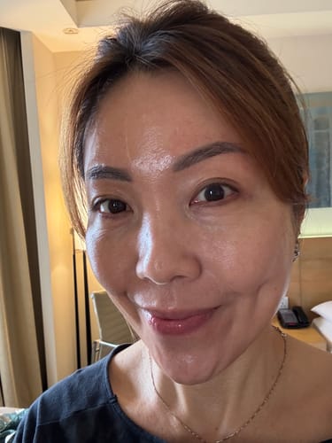 Customer photo review of OUTGLOW - Radiance Tri-Factor™ Jelly (Subscription)