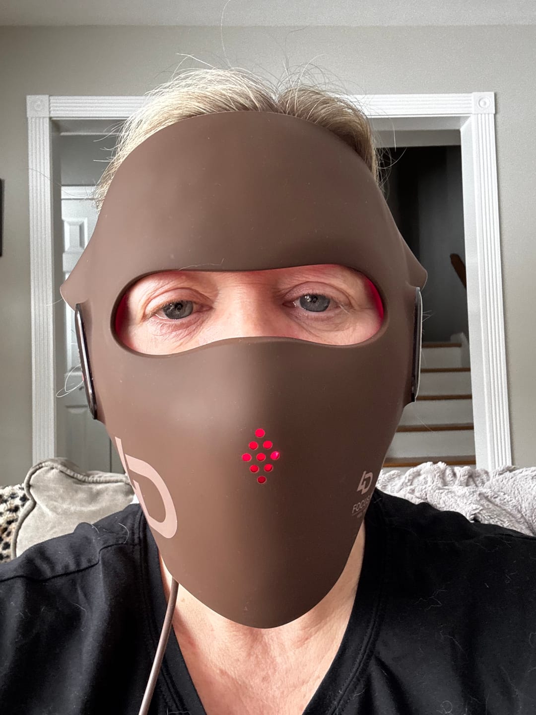 Customer photo review of JOVS 4D Laser Light Therapy Mask