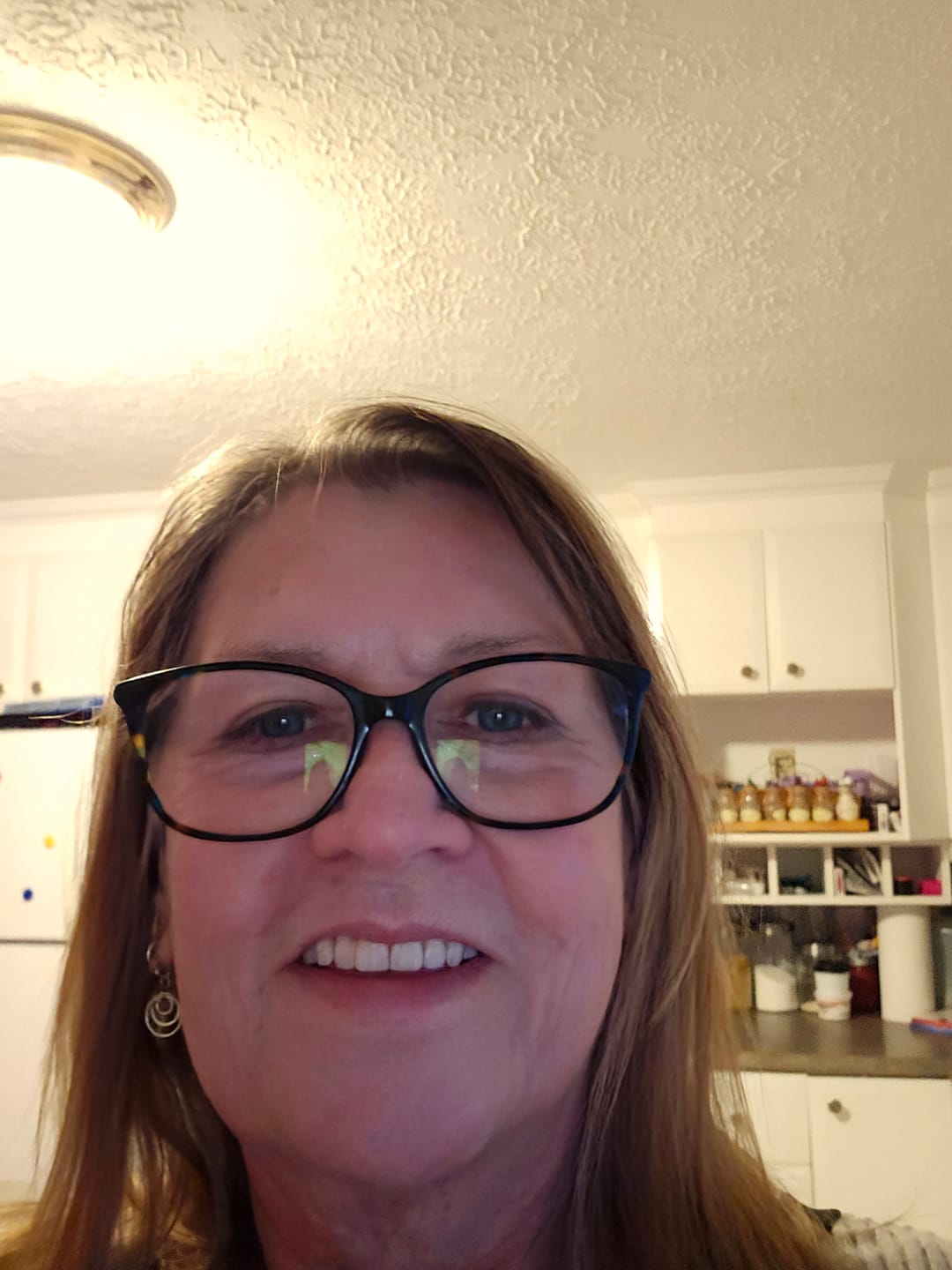 Customer photo review of Ultime Elixir Sérum Anti-Âge