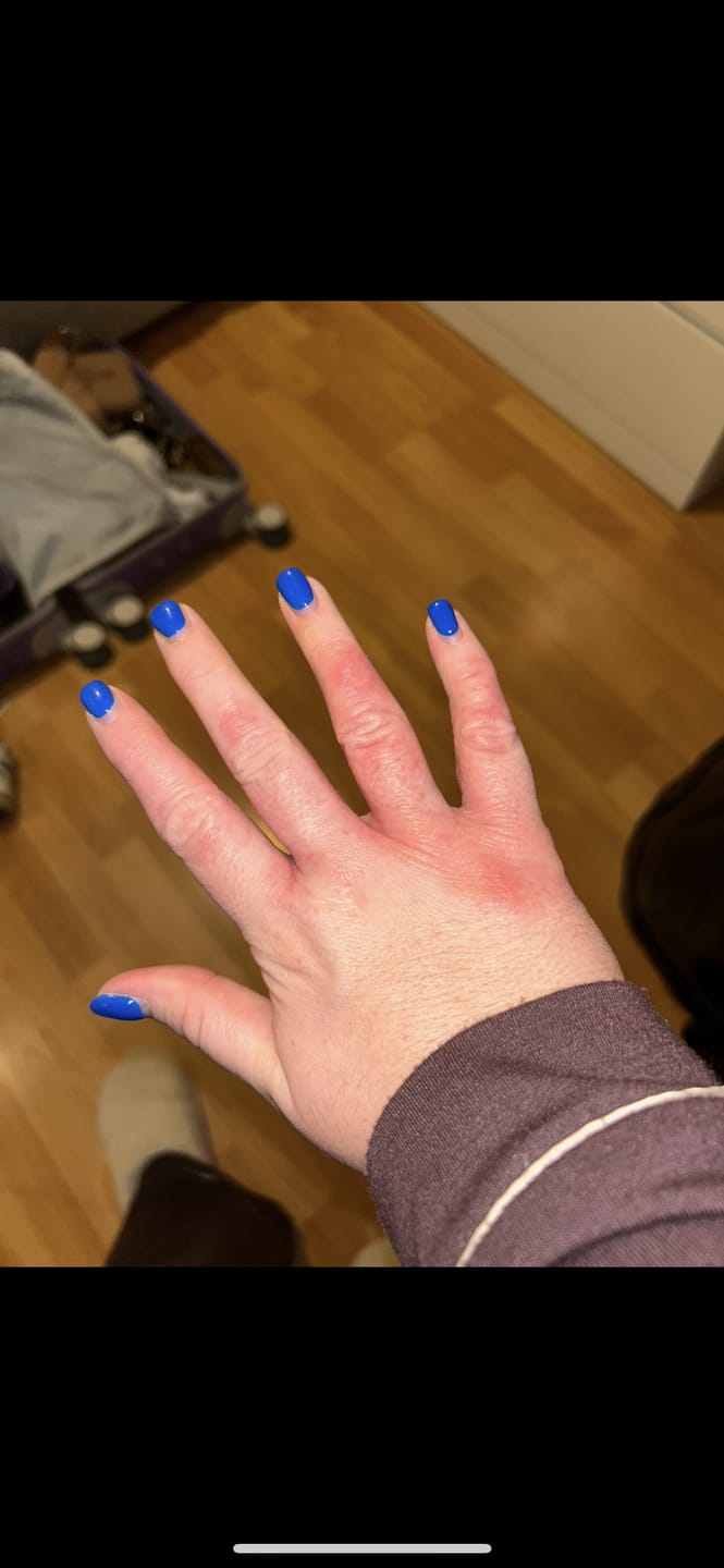Customer photo review of Bioskin Duo Pack