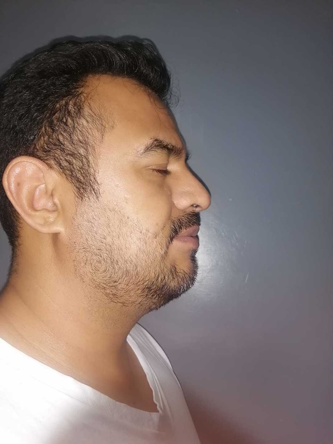 Customer photo review of 1 Bálsamo Mélamus