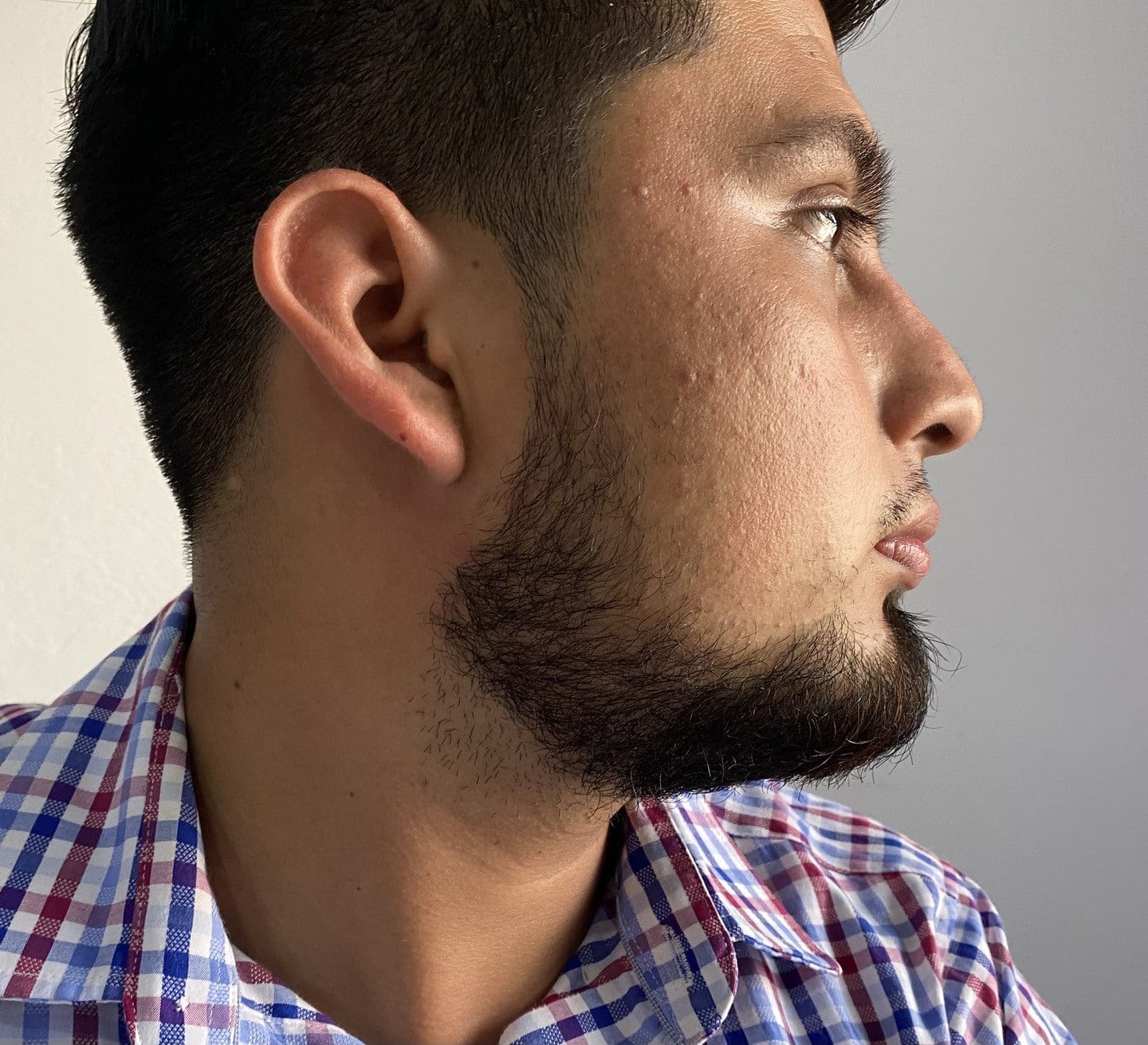 Customer photo review of 1 Bálsamo Mélamus