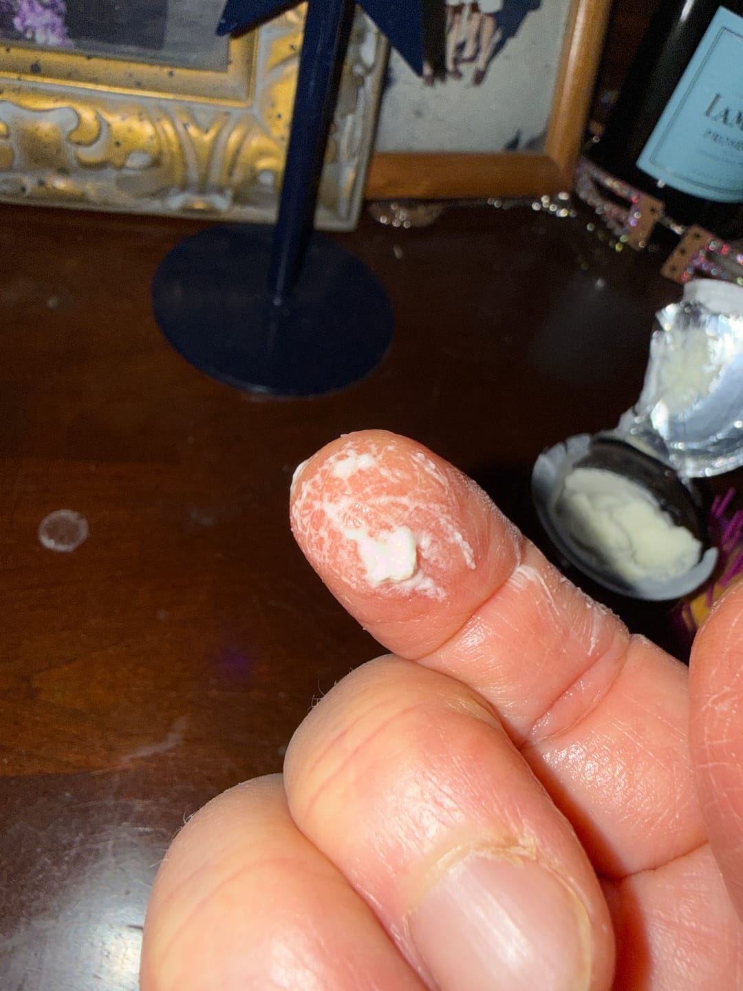 Customer photo review of Relaxing Tallow Balm