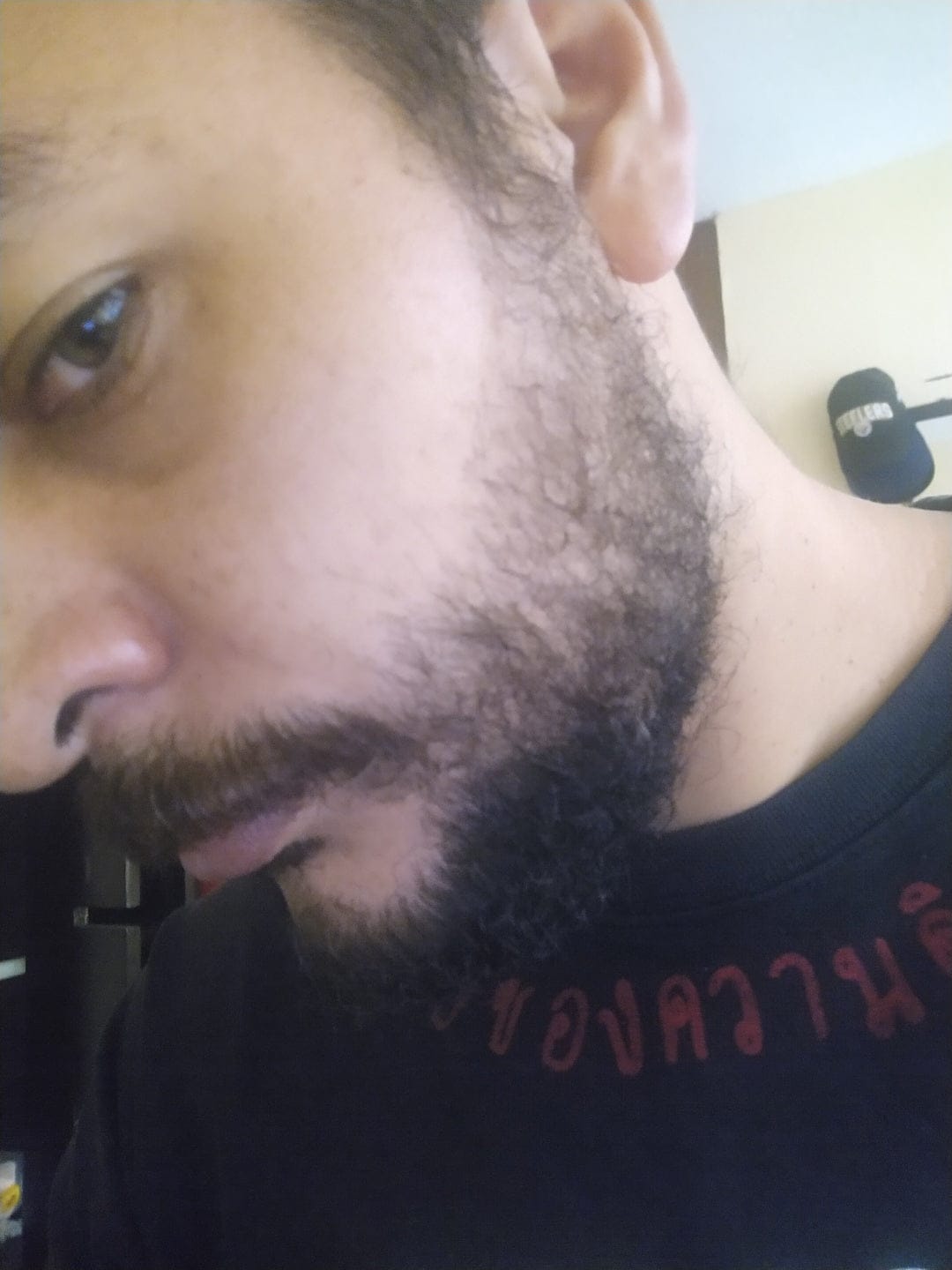 Customer photo review of 2 Bálsamos Mélamus + 1 Dermaroller Gratis