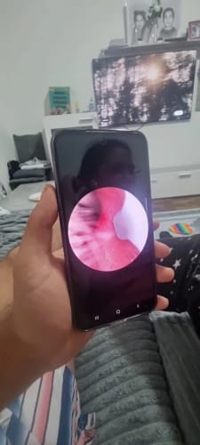 Customer photo review of LumaEar™ Pro