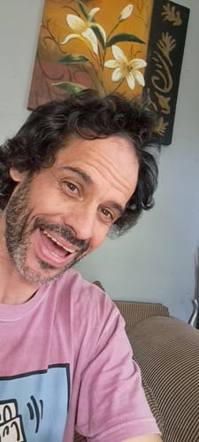 Customer photo review of Minoxidil DOUBLE ACTION FOAM, MEN ONLY 3x60ml Pack