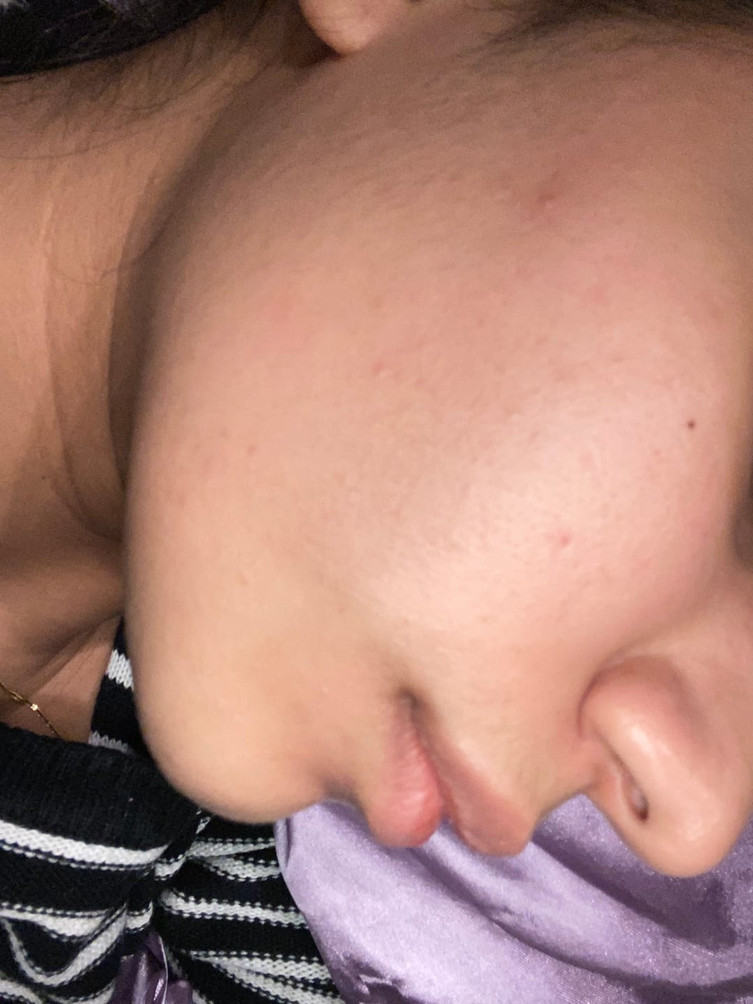 Customer photo review of Hydrobase Serum