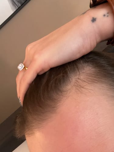 Customer photo review of FAVORYT Hair Growth Oil - now with Batana Oil 🌱