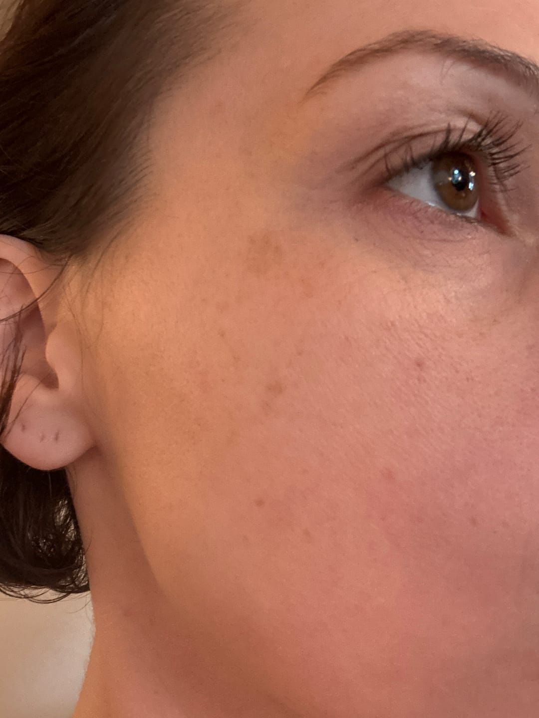 Customer photo review of FAVORYT Skin Glaze Sampler Bundle  Three Targeted Moisture Treatments for Clearer, Calmer, More Radiant Skin