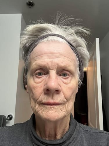A reviewer's face with visible deep wrinkles, documenting their experience with Deep Collagen Cream.