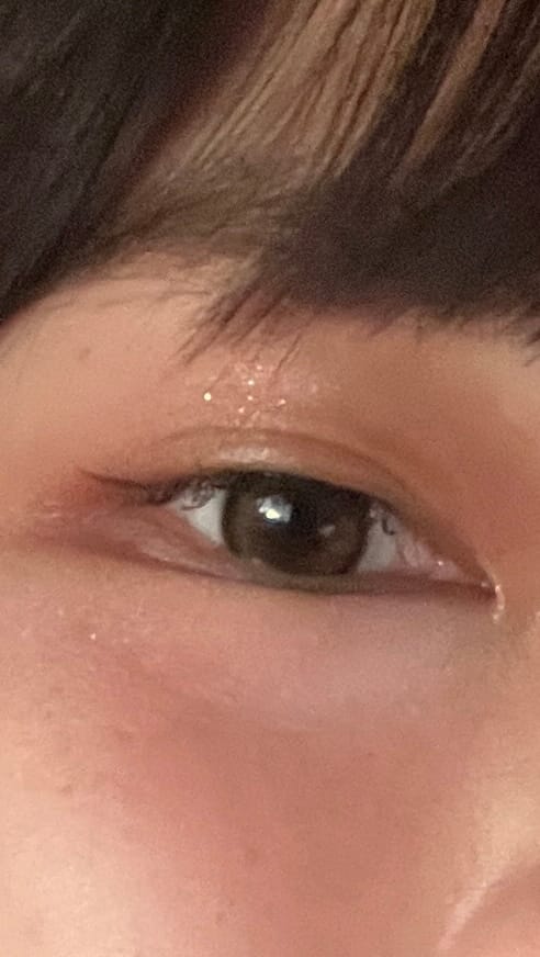 Customer photo review of Olens ViVi Ring 1 Day Brown 日拋隱形眼鏡