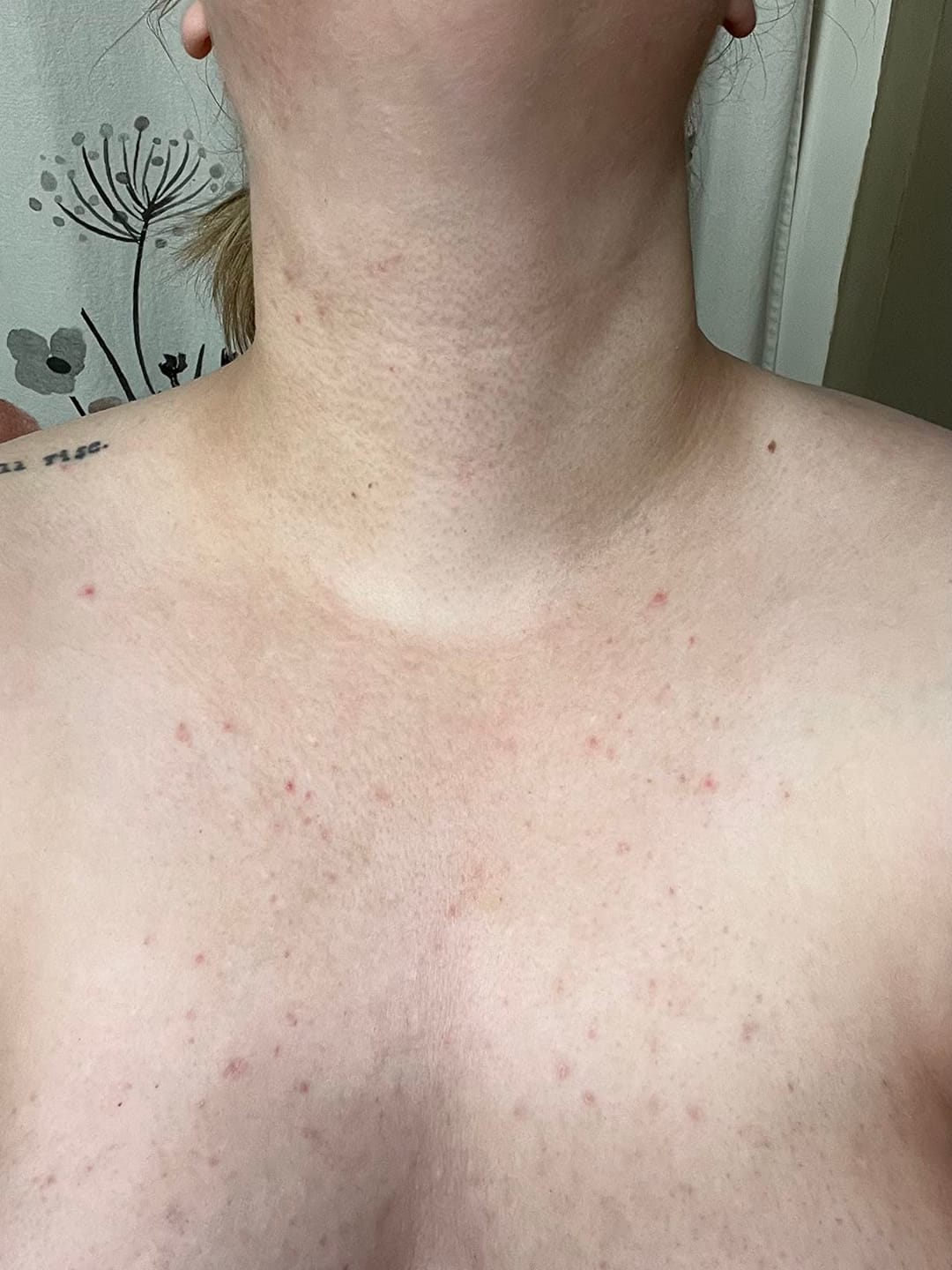 Customer photo review of Glow Factory Ексфолиращ Стик За Тяло