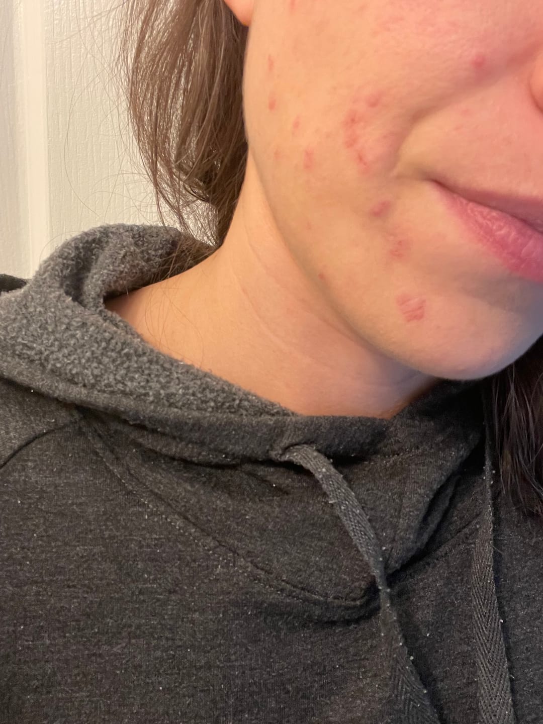 Customer photo review of AndroEase Plus - 50% Off First Order