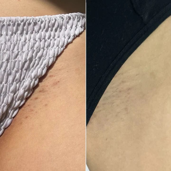 Customer photo review of Glow Factory Ексфолиращ Стик За Тяло