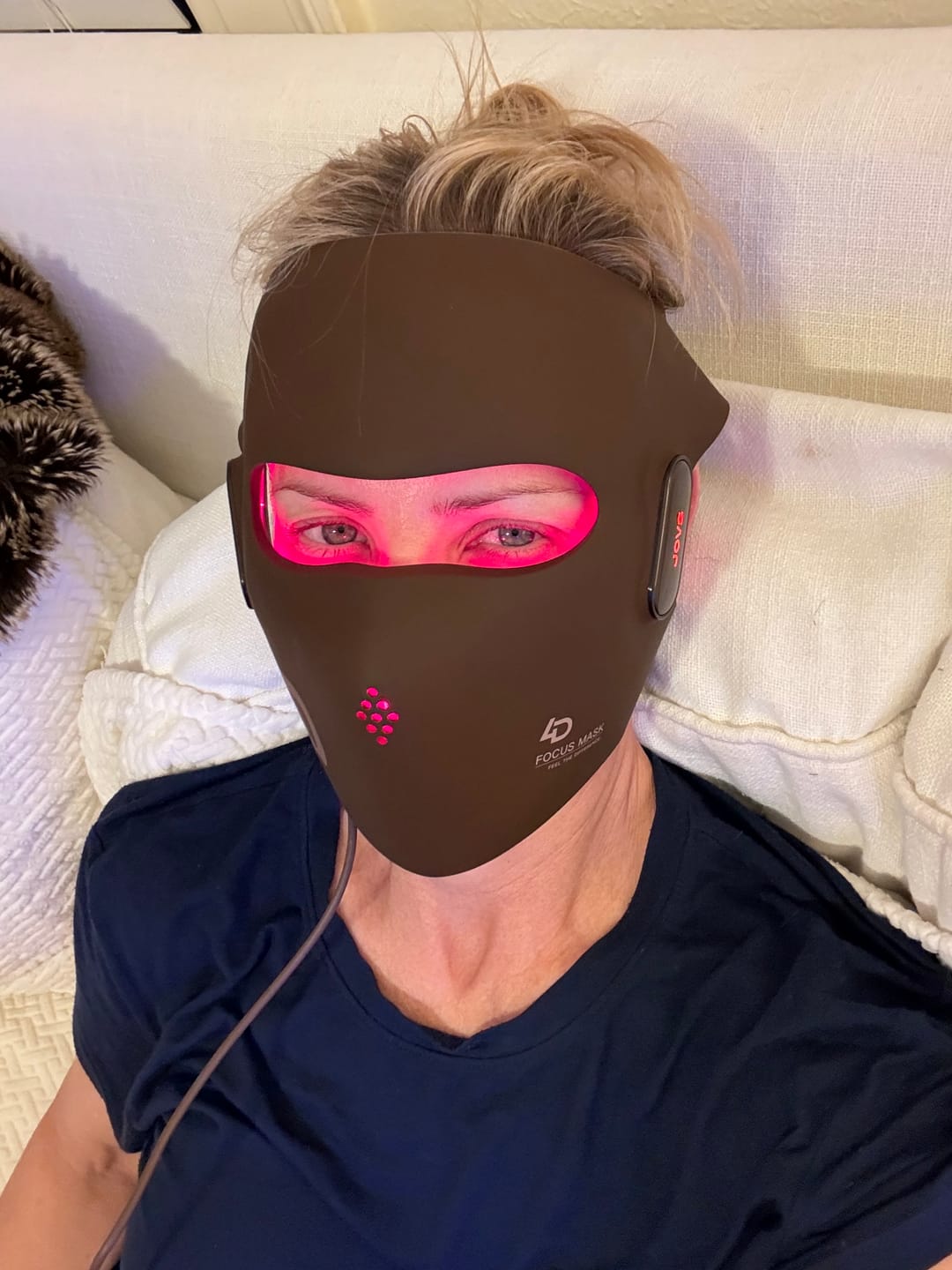 Customer photo review of JOVS 4D Laser Anti-Aging Therapy Mask