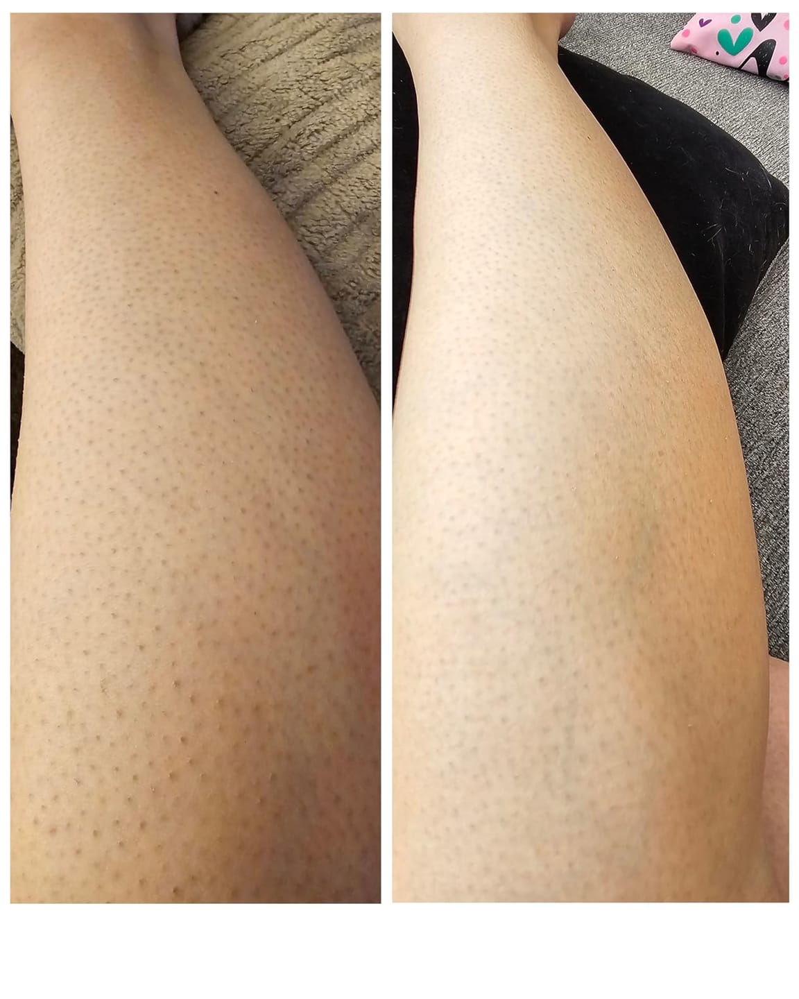 Customer photo review of Glow Factory Ексфолиращ Стик За Тяло