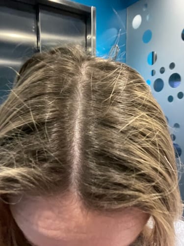 Customer's hair showing dark roots before using the Sunkissed Starter Kit.