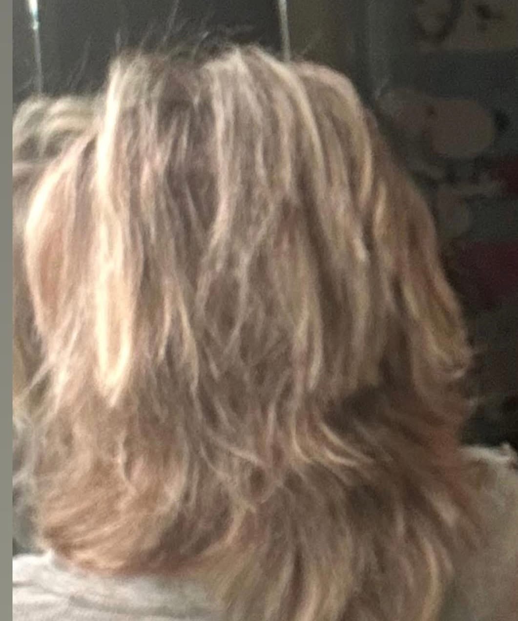 Customer photo review of Hair Growth Bundle
