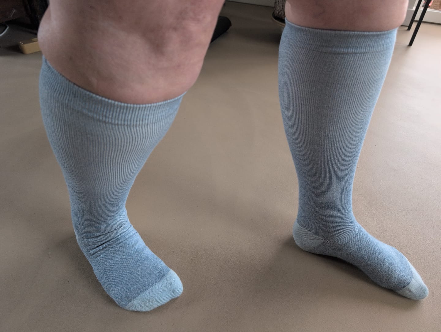 Customer photo review of Blue Breeze Compression Socks