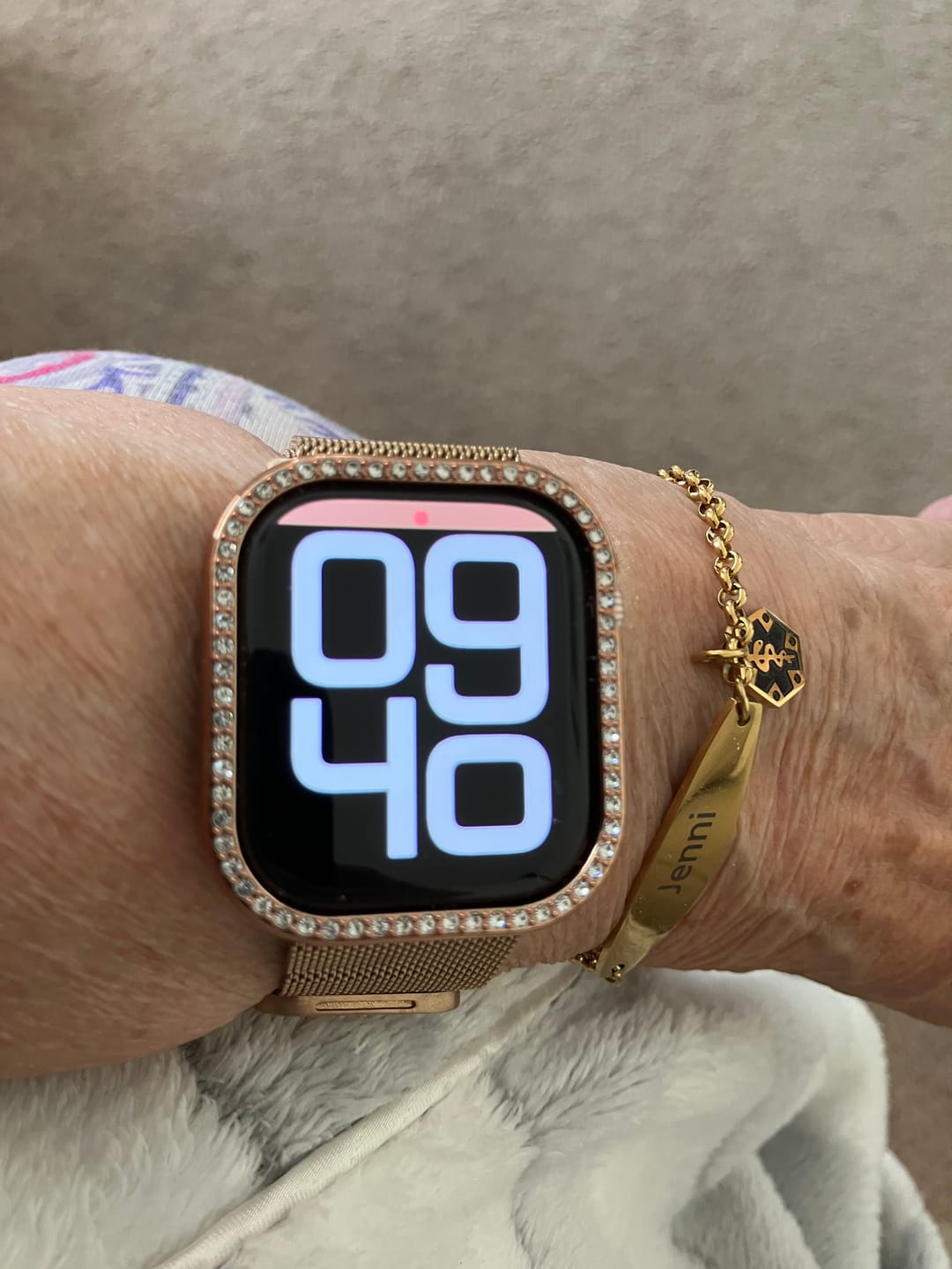 Customer photo review of Gold Colour Medical Alert Bracelet with Medical Charm