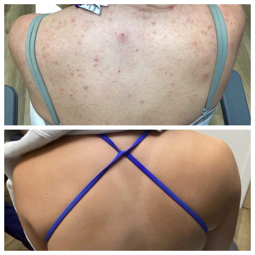 Customer photo review of Glow Factory Ексфолиращ Стик За Тяло