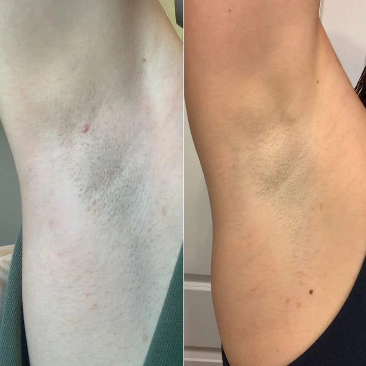 Customer photo review of Glow Factory Ексфолиращ Стик За Тяло