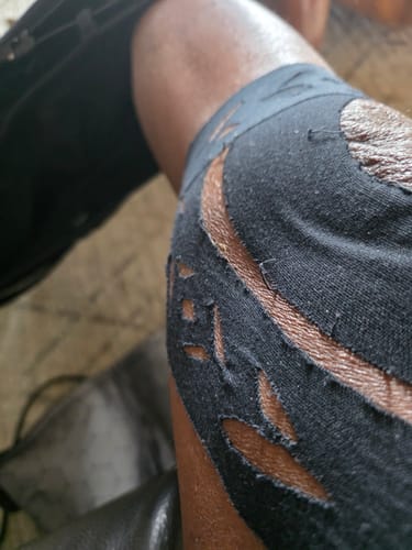 Customer photo review of Easy Kinesiology Tape (30-Day Supply)