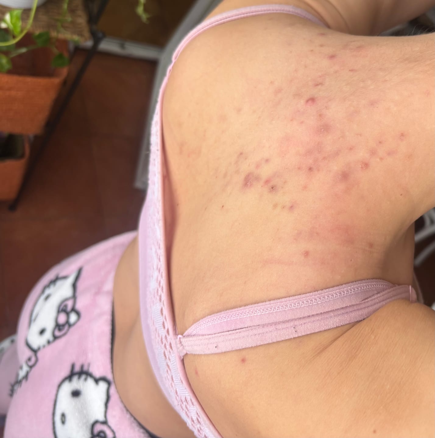 Customer photo review of A CONTROL + CORTIZEN - Equilibrio hormonal desde el cerebro, los ovarios, la piel y el metabolismo.
