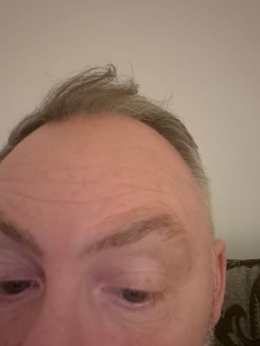 Customer photo review of Seb Natural Calming Serum