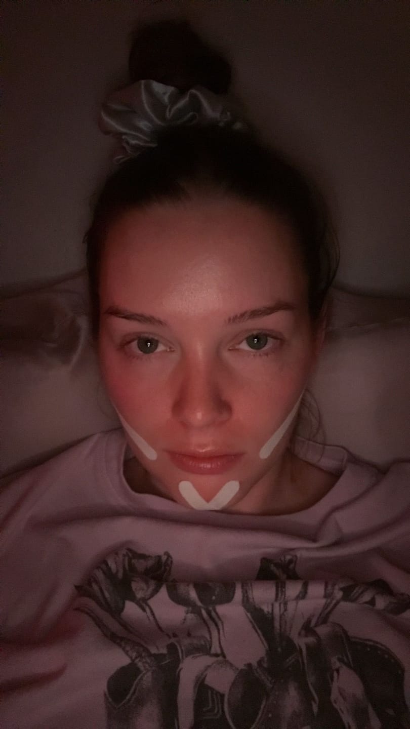 Customer photo review of Zygo Tape - Facial Sculpting & Anti-Aging Tape For Women