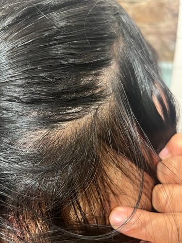 Customer photo review of Seb Natural Calming Serum