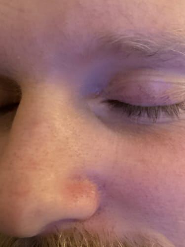 Customer photo review of Seb Natural Calming Serum