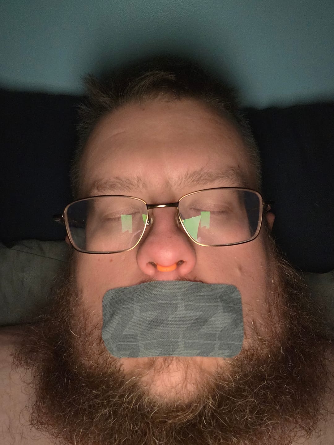 Customer photo review of ZzzTape - Mouth Tape