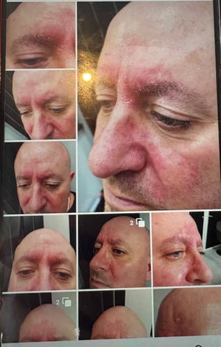 Customer photo review of Seb Natural Calming Serum