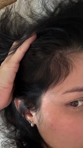 Customer photo review of VITAFOAM ™ Hair Growth Formula