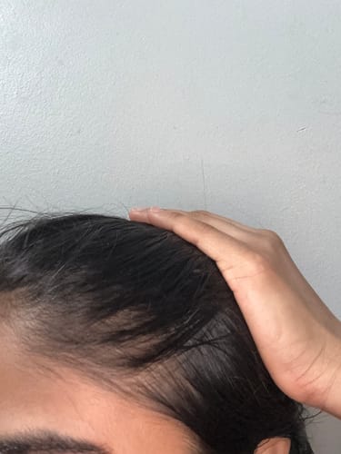 Customer photo review of Full Regrowth Kit™