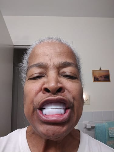 Customer photo review of 🦷  Fit Full Functional DenturesMake you more confident-Made in the USA & FDA-Certified