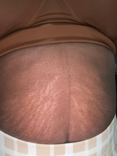 Customer photo review of Flat Belly Syrup