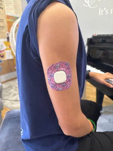 Customer photo review of Simplera Sensor Patches - Patch Me UP !