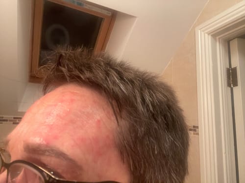 Customer photo review of Facial Revival Bundle