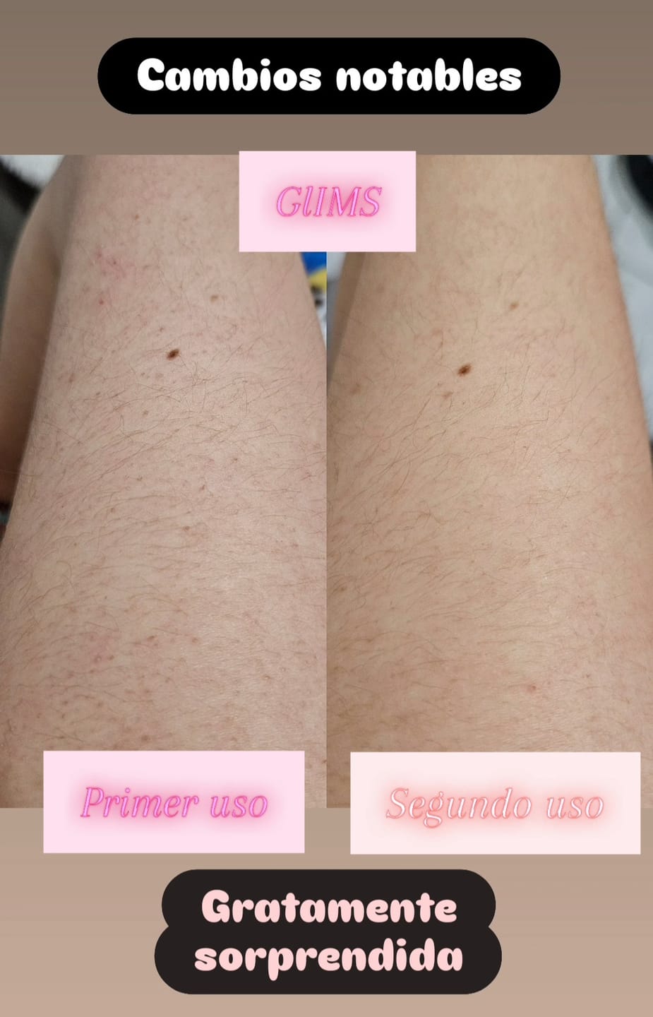 Customer photo review of GLIMS Guantes Exfoliantes