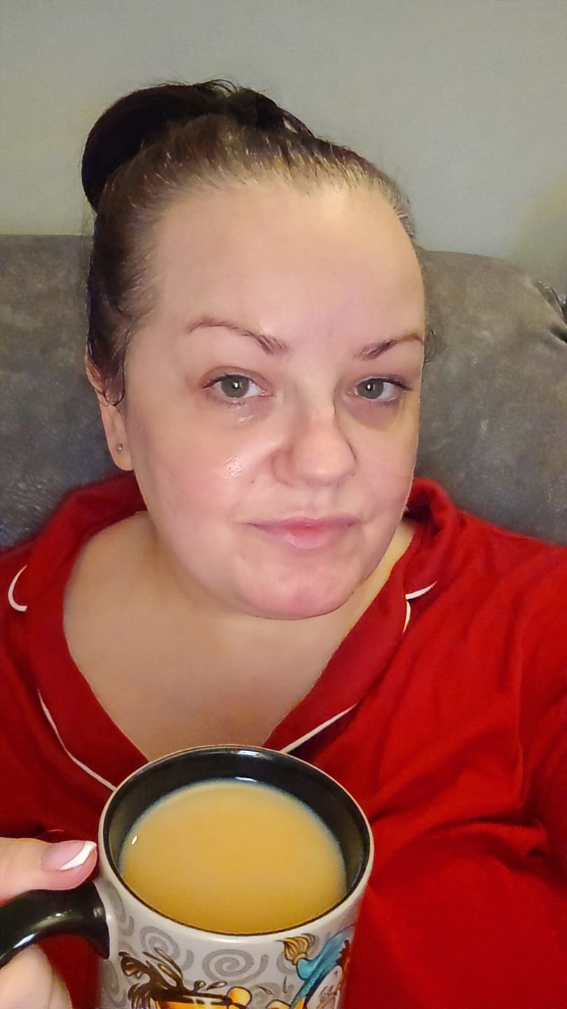 Customer photo review of Hydrating Eye Gels