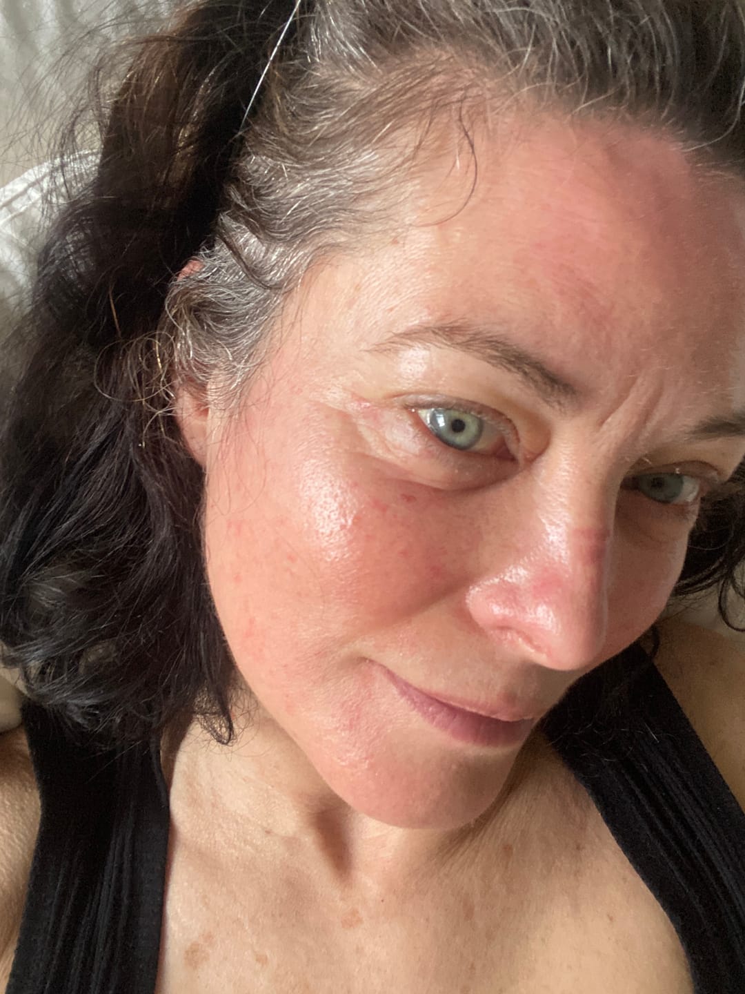 Customer photo review of Sea Cucumber Collagen Instant Lift Eye Serum