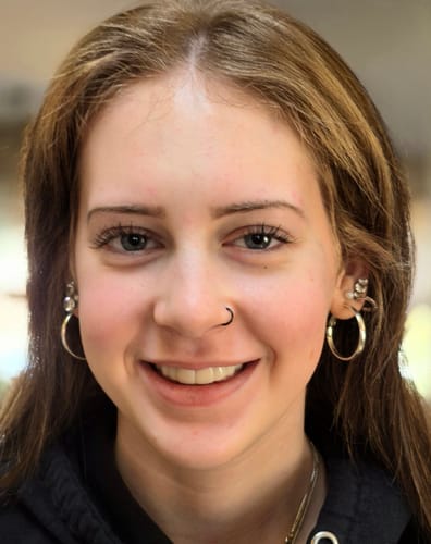 Customer showing off her great-looking smile with Pop On Veneers.