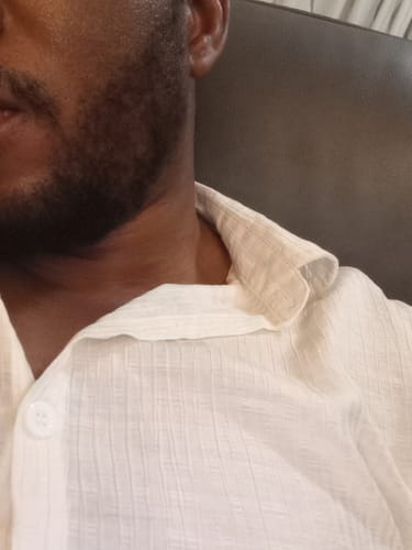 Customer photo review of Minoxidil 5% FOAM, 3x60ml pack