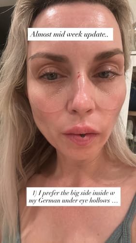 Customer photo review of Collagen eye patch Jericho rose jelly