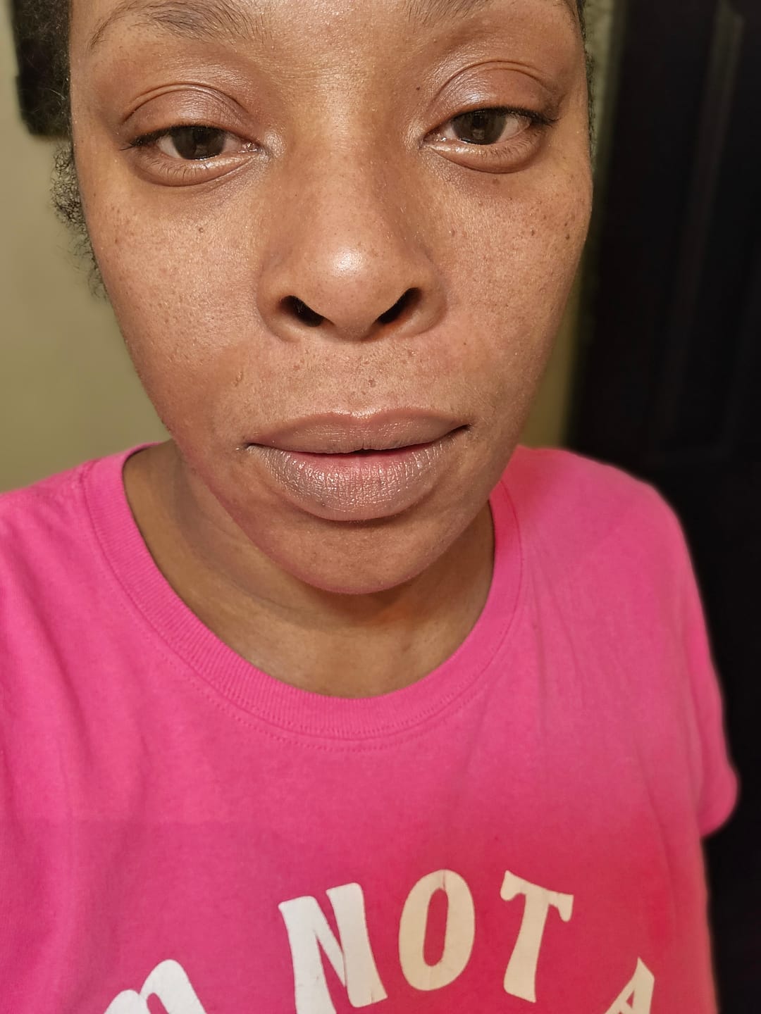 Customer photo review of Brightening Lip Bundle