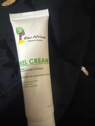 Customer photo review of Urea Heel Cream